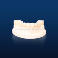 High Quality Multilayered Zirconia for Dental Restorations